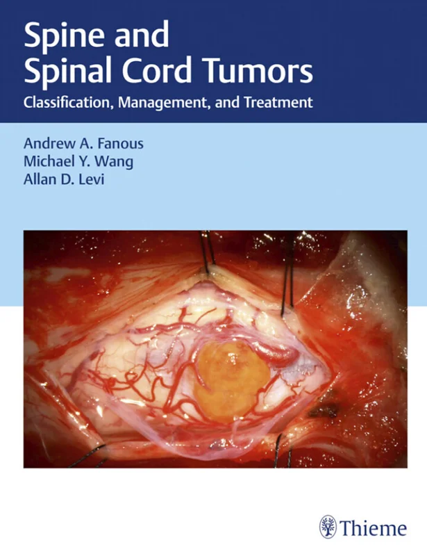 Spine and Spinal Cord Tumors: Classification, Management, and Treatment