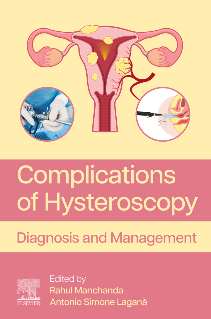 Complications of Hysteroscopy: Diagnosis and Management